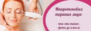 Микротоковая терапия лица: что это такое, противопоказания, фото до и после () Микротоковая терапия лица: что это такое, противопоказания, фото до и после