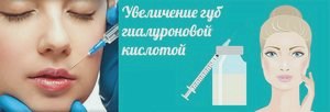 Гиалуроновая кислота в губы: фото, отзывы, советы () Гиалуроновая кислота в губы: фото, отзывы, советы