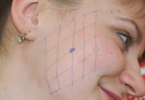 Брыли на лице: как убрать в домашних условиях () Брыли на лице: как убрать в домашних условиях