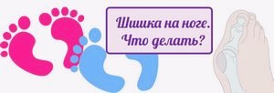 Шишка на ноге у большого пальца - причины, лечение () Шишка на ноге у большого пальца - причины, лечение