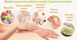 Ломкие ногти на руках: причины, лечение, витамины () Ломкие ногти на руках: причины, лечение, витамины