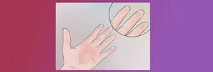 Слезает кожа на пальцах: причины, лечение () Слезает кожа на пальцах: причины, лечение